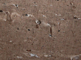 CYGNUS GRANITE
